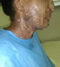 Photo of Hombre le prende fuego a una señora en Bonao