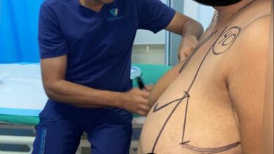 Photo of Cirujano Vargas Almonte aboga por que las ARS cubran las cirugías de reducción mamaria
