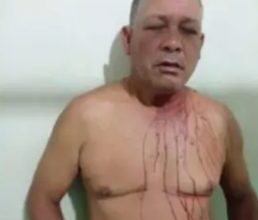 Photo of Buscan hombre agredió  a tiros a su expareja y supuesto acompañante en Dajabón