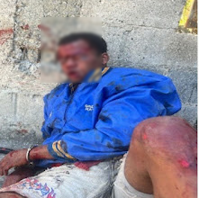 Photo of Motoristas hieren y golpean delincuente que mató en atraco a compañero en Pantoja